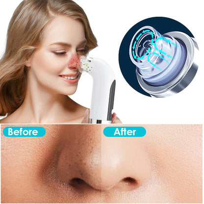 Blackhead Remover Pore Vacuum Cleaner Upgraded Blackhead Vacuum Rechargeable Face Vacuum Comedone Extractor Tool For Blackhead