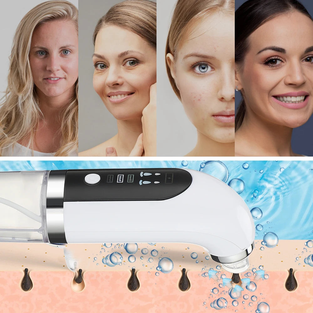 Blackhead Remover Pore Vacuum Cleaner Upgraded Blackhead Vacuum Rechargeable Face Vacuum Comedone Extractor Tool For Blackhead